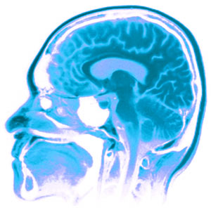 Brain MRI Brain MRI