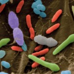 How to Manage 100 Trillion Bacteria in Your Gut